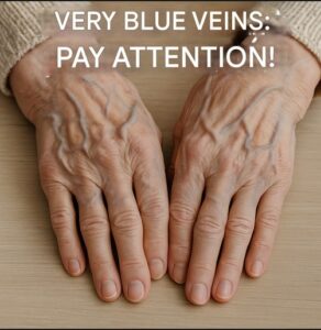 Blue veins on the skin: why they appear, when to worry and how to take care of your vascular health