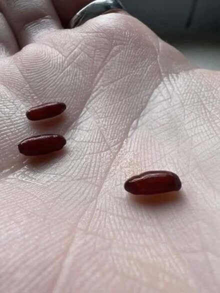 A Family’s Warning After a Sudden, Devastating Tick-Borne Illness