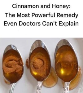Cinnamon and Honey: The Most Powerful Remedy Even Doctors Can’t Explain