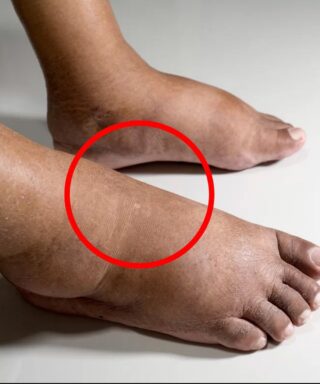 10 Natural Herbs That Help Reduce Foot Swelling and Support Healthy Circulation